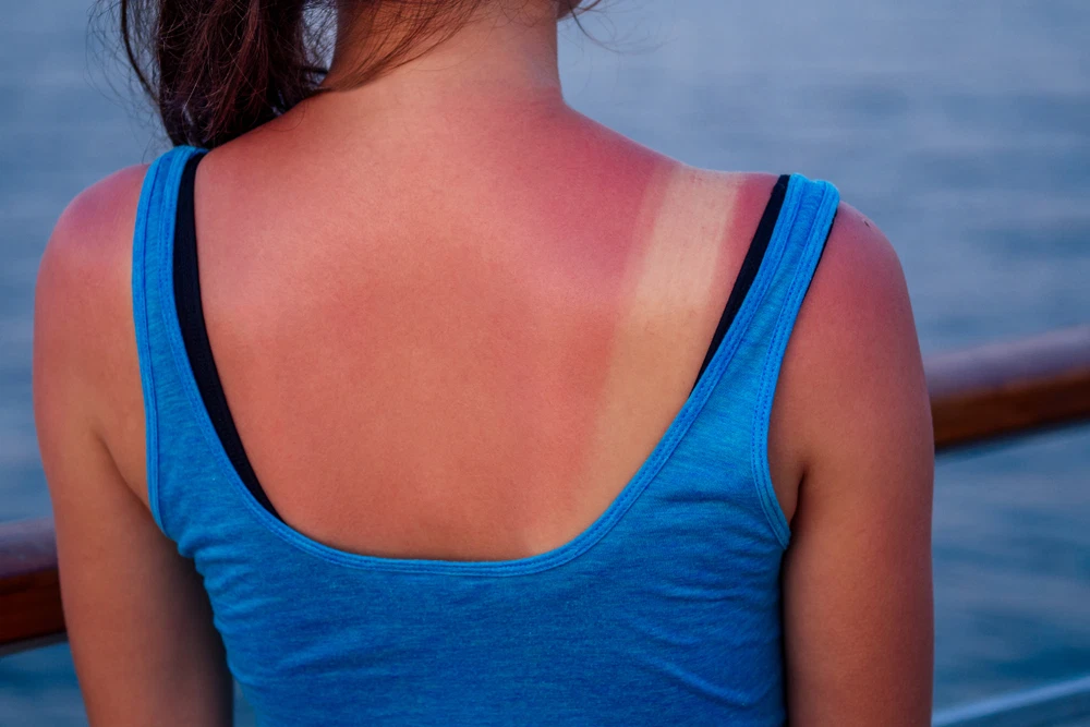 Can You Erase Years Of Sun Damage?