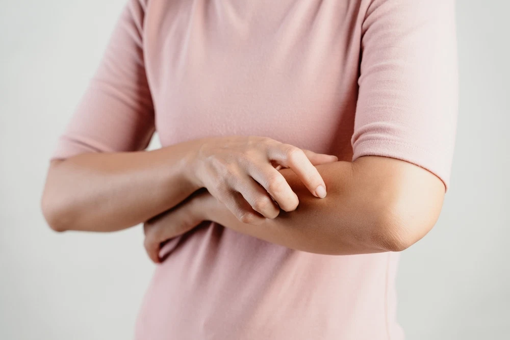 Managing Chronic Itchy Skin (Pruritus)