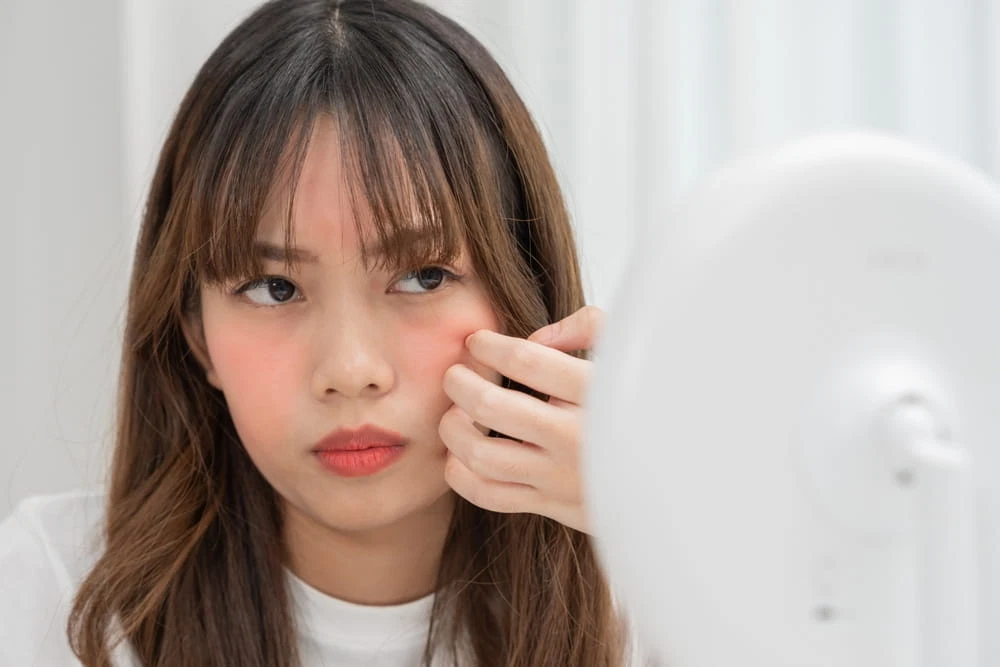 How Hormonal Changes Affect Your Skin (Menopause, Puberty)