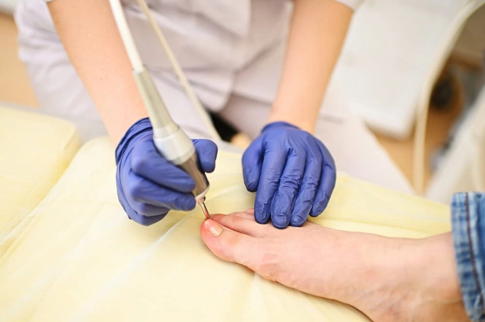 How to Treat and Prevent Fungal Infections
