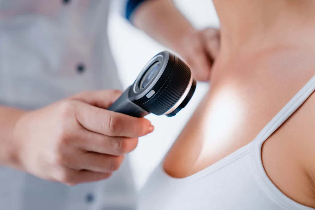 A medical provider using a dermatoscope for a skin examination.