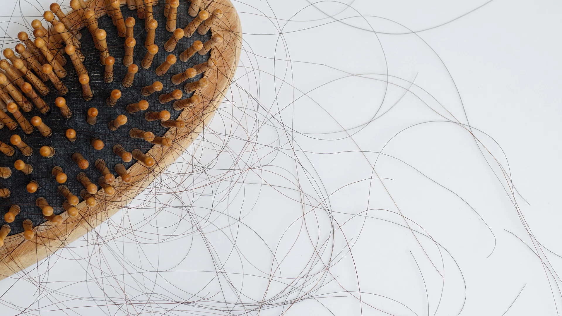 Stress And Hair Loss: How They Are Connected And Slowing The Effects